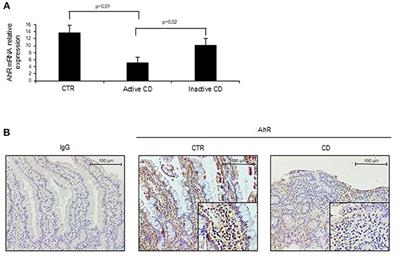 Protective Effects of Aryl Hydrocarbon Receptor Signaling in Celiac Disease Mucosa and in Poly I:C-Induced Small Intestinal Atrophy Mouse Model